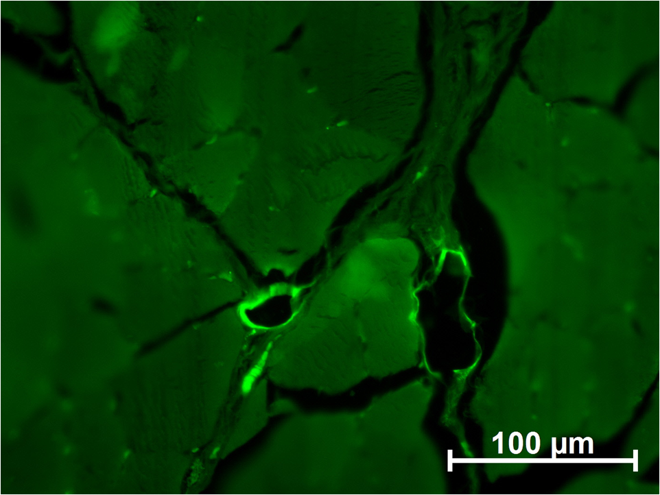 Ангиогенез после введения стволовых клеток в тромбированную вену. Неокрашенные срезы в отраженном ультрафиолетовом свете с фильтром «Alexa 488». Сосуды и их цепочки с ярким специфическим свечением тонких стенок расположены в мышцах бедра к 2 неделе после введения стволовых клеток в вену при тромбозе. 