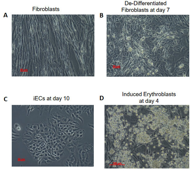 Фибробласты, прогениторные клетки, индуцированные эндотелиальные клетки и индуцированные эритробласты