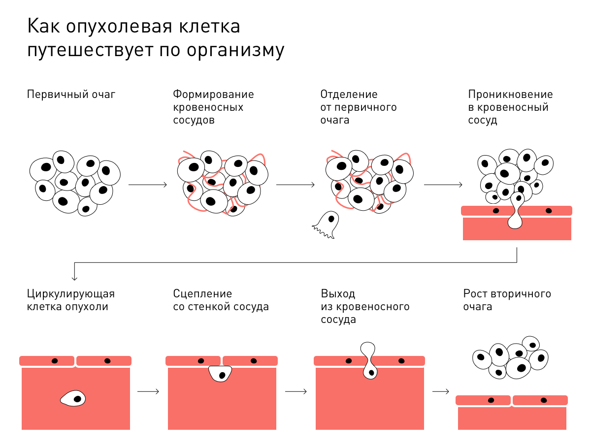 путешествие опухоли