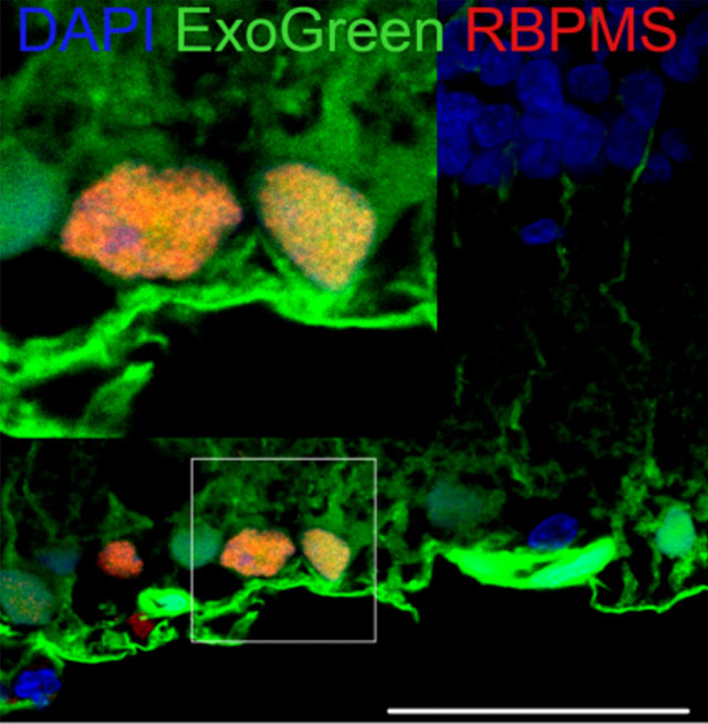 exosomes