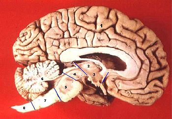 350px Human brain midsagittal cut description