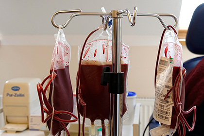 Омоложение переливанием крови
