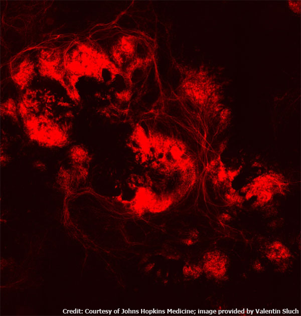 retinal ganglion cells