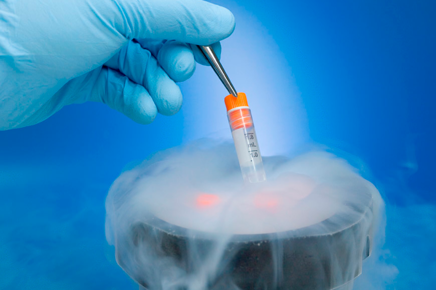 fertility EGGfreezing wyduit