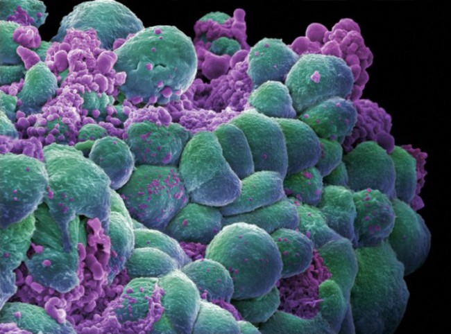 breast cancer cells 650x482