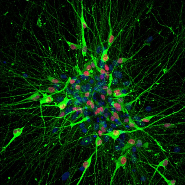 serotonin neuron